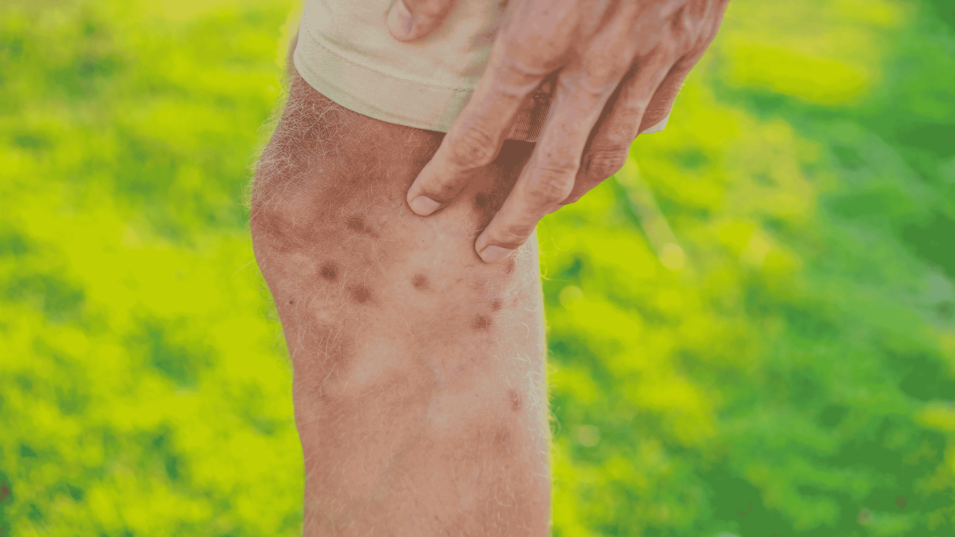 Mosquito Control in Fletcher, NC